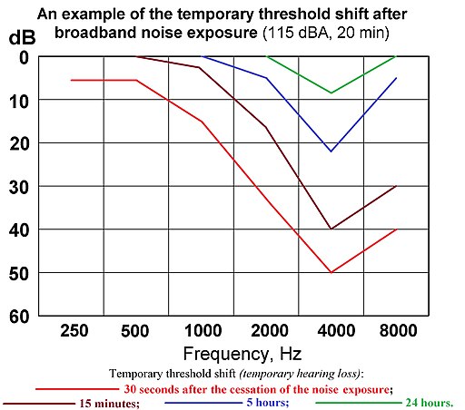 There is nothing temporary about temporary threshold shift